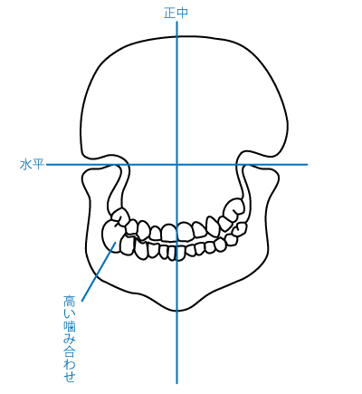 顎関節症について：図1　正しい噛み合わせ